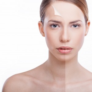 Image of woman with half of her face peeling